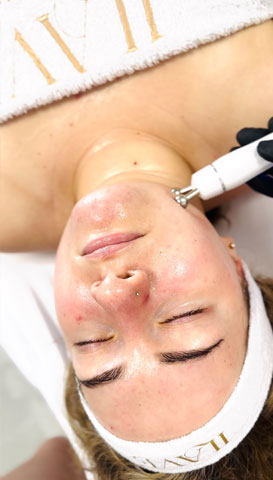 Lifting RF odmłodzenie w Ilave Łuków