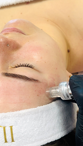 wodorowe oczyszczanie skóry w Ilave Łuków